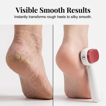 ✨🦶Double-Sided Foot Scraper – Easily Removes Calluses and Dead Skin